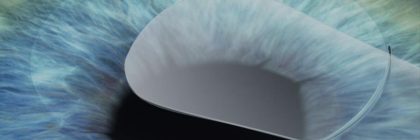 92acfcc8-3b92-40f9-ab31-9567a59b3b7d